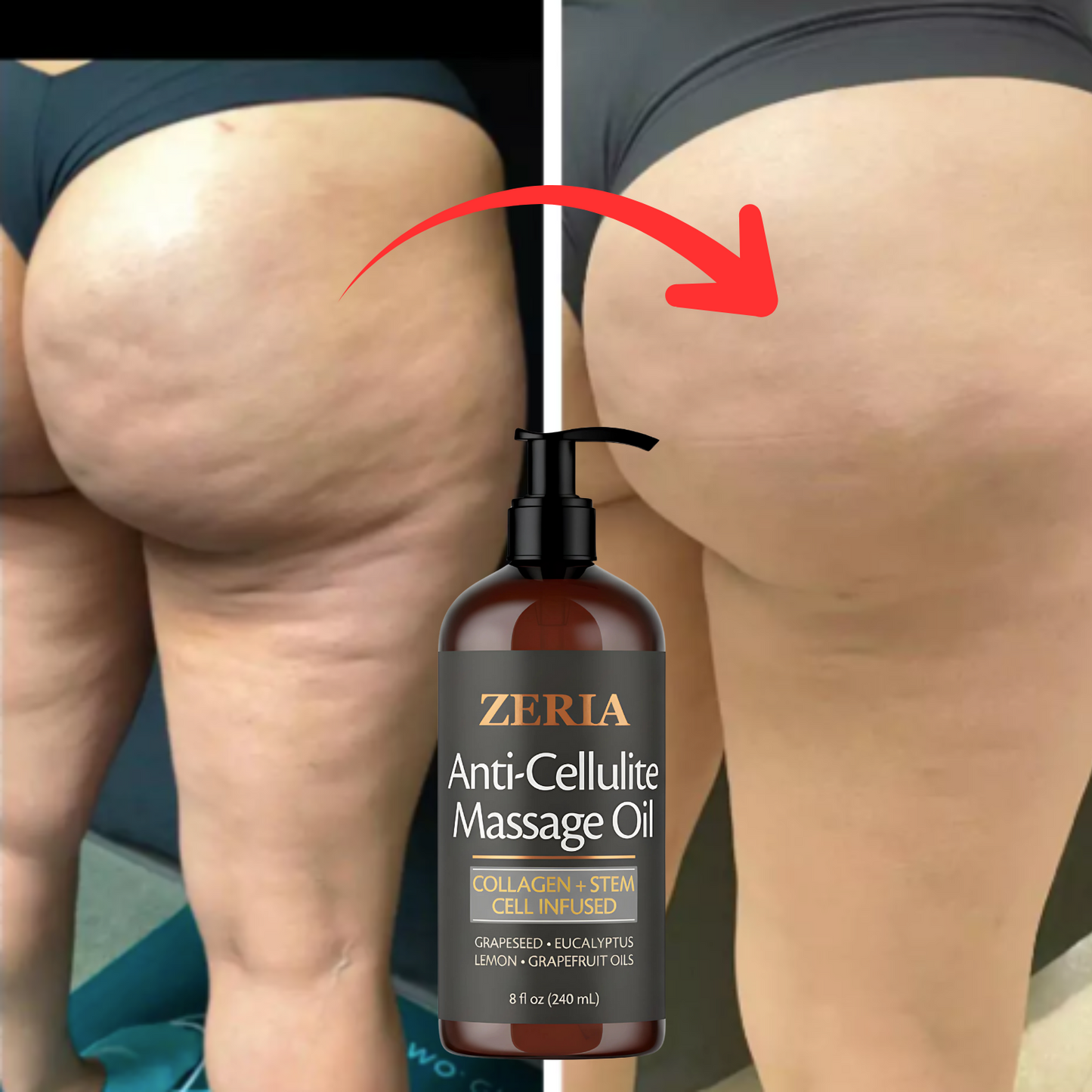 Cellulite Massage Oil