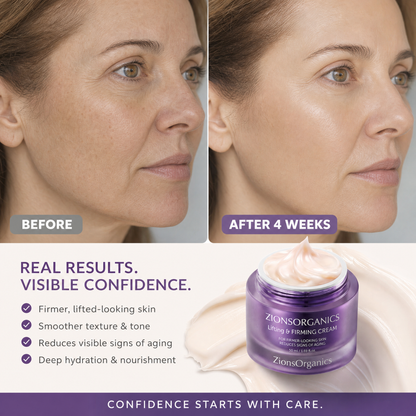 Advanced Lifting Cream